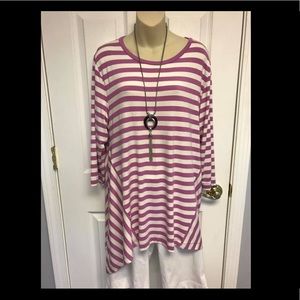 Striped tunic
